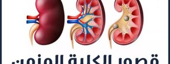 القصور الكلوي المزمن، أسبابه وطرق علاجه