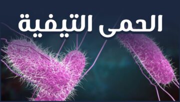 ما أعراض هذا المرض؟ وما أسبابه؟ وما هي طرق العلاج والوقاية منه؟