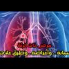 مرض ذات الرئ