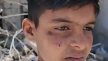 الأطفال يدفعون الثمن… معاناة يومية على حي طريق الباب في حلب، مع انتشار الأمراض و اللشمانيا